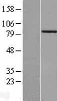 ACAD11 Protein (Over-Expression Lysate Myc-DDK (Flag))