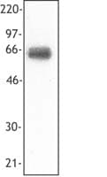TREM1 Antibody (clone TREM-26)