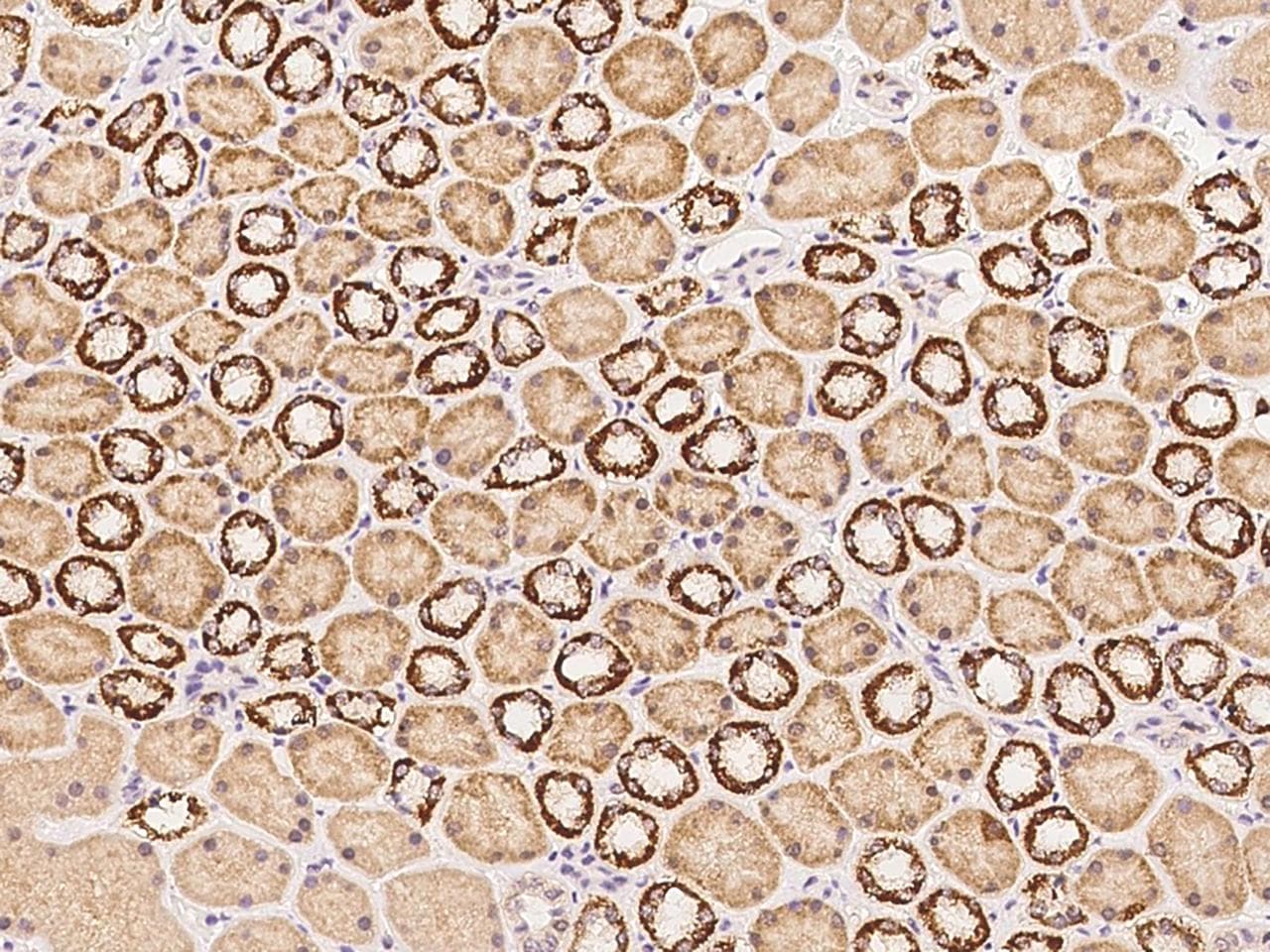 EGLN1 / PHD2 Antibody