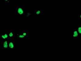 UNG / Uracil DNA Glycosylase Antibody (clone OTI2F3)