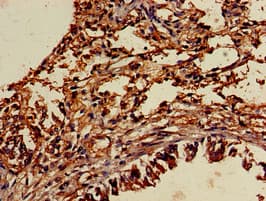 IHC-plus™ TYRO3 Antibody