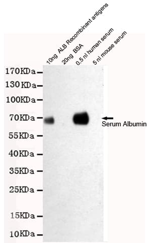 Monoclonal Mouse anti-Human ALB / Serum Albumin Antibody (WB)
