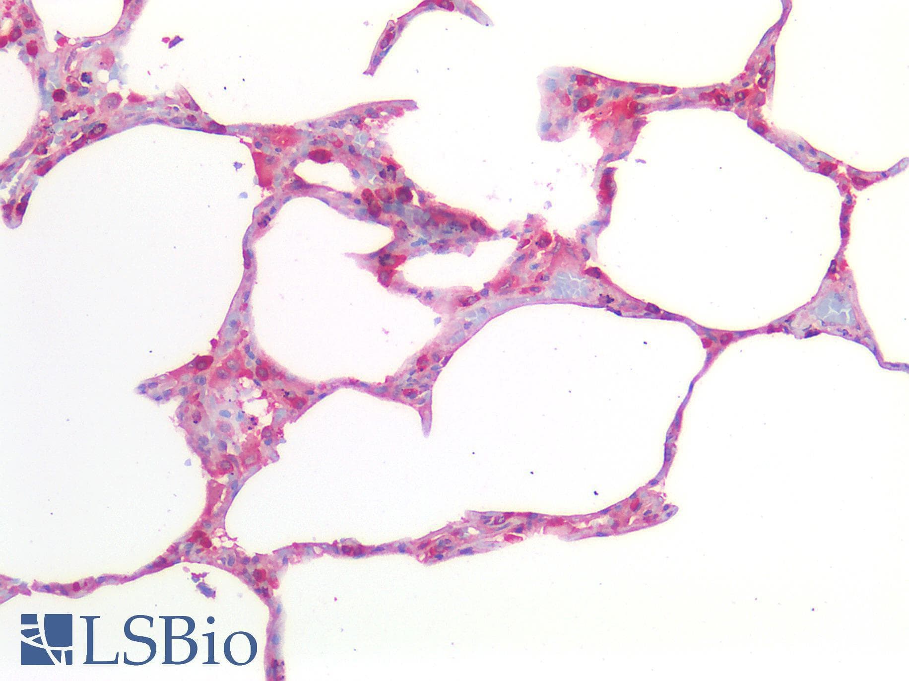 IHC-plus™ MMP2 Antibody