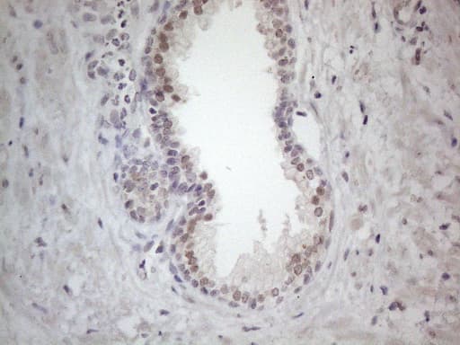 CSA / ERCC8 Antibody (clone OTI2G1, Carrier-free)