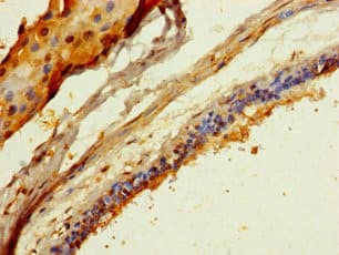 COL20A1 / Collagen XX Antibody