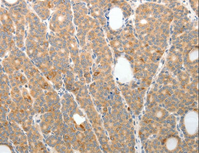 TP1 / TEP1 Antibody