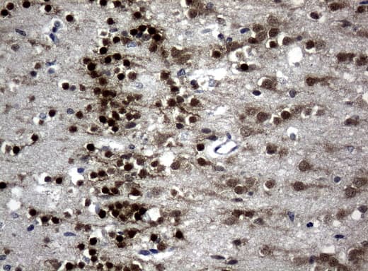 MEF2C Antibody (clone UMAB17)