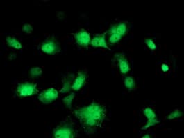 PMVK Antibody (clone OTI2F9, Carrier-free)