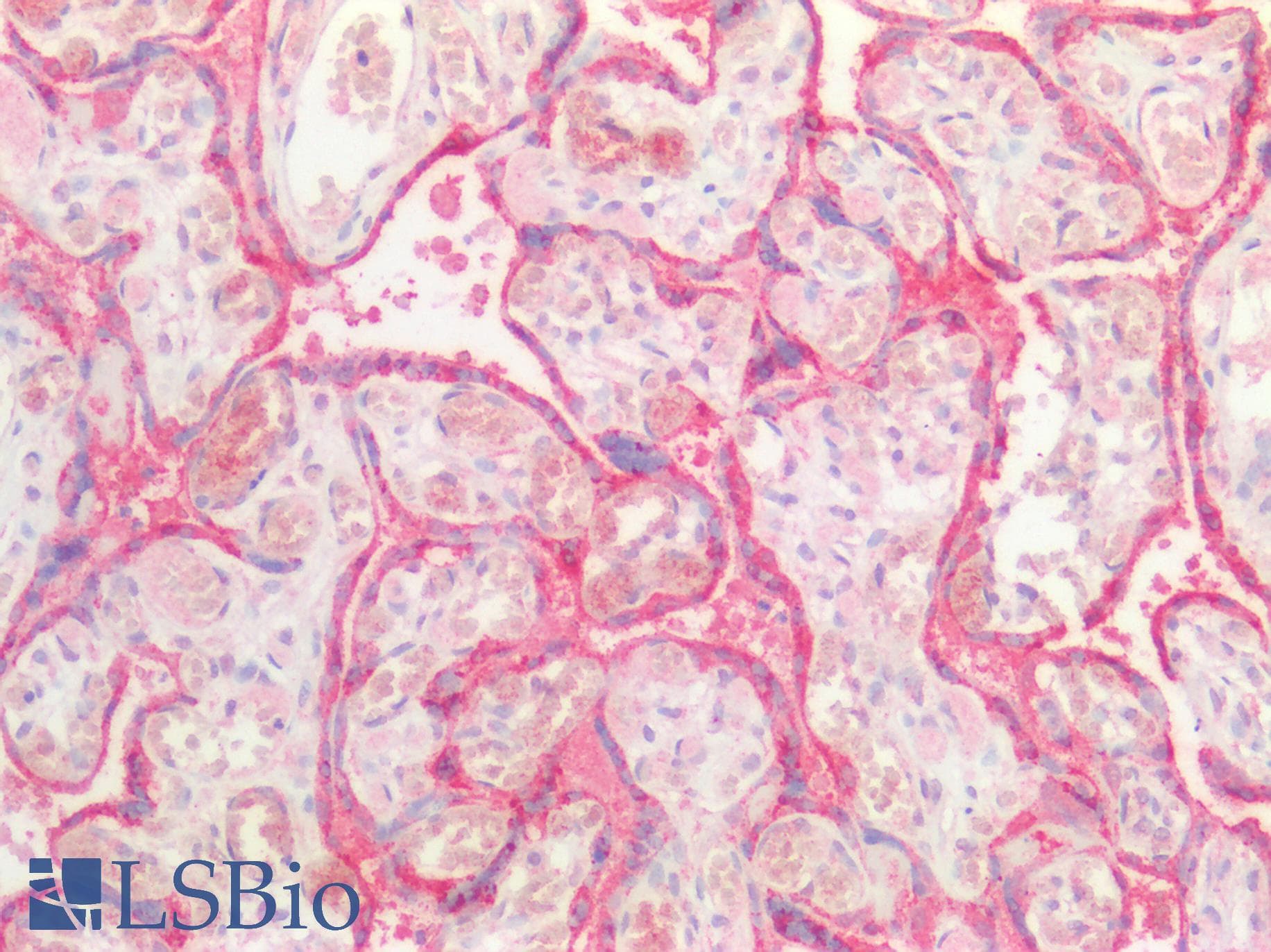 PathPlus™ KRT5 / CK5 / Cytokeratin 5 Antibody