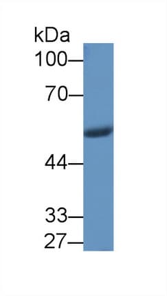 NAMPT / Visfatin Antibody (aa1-491, APC)
