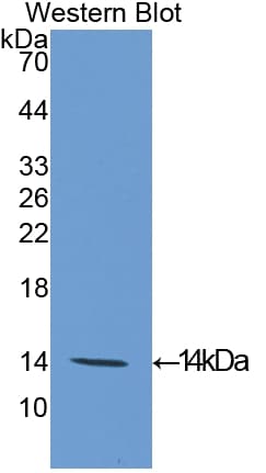 EIF4EBP1 / 4EBP1 Antibody (aa2-117)