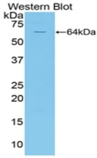 CD95 / FAS Antibody (aa22-172)