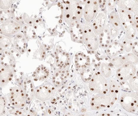 PRKCA / PKC-Alpha Antibody (phospho-Thr638)