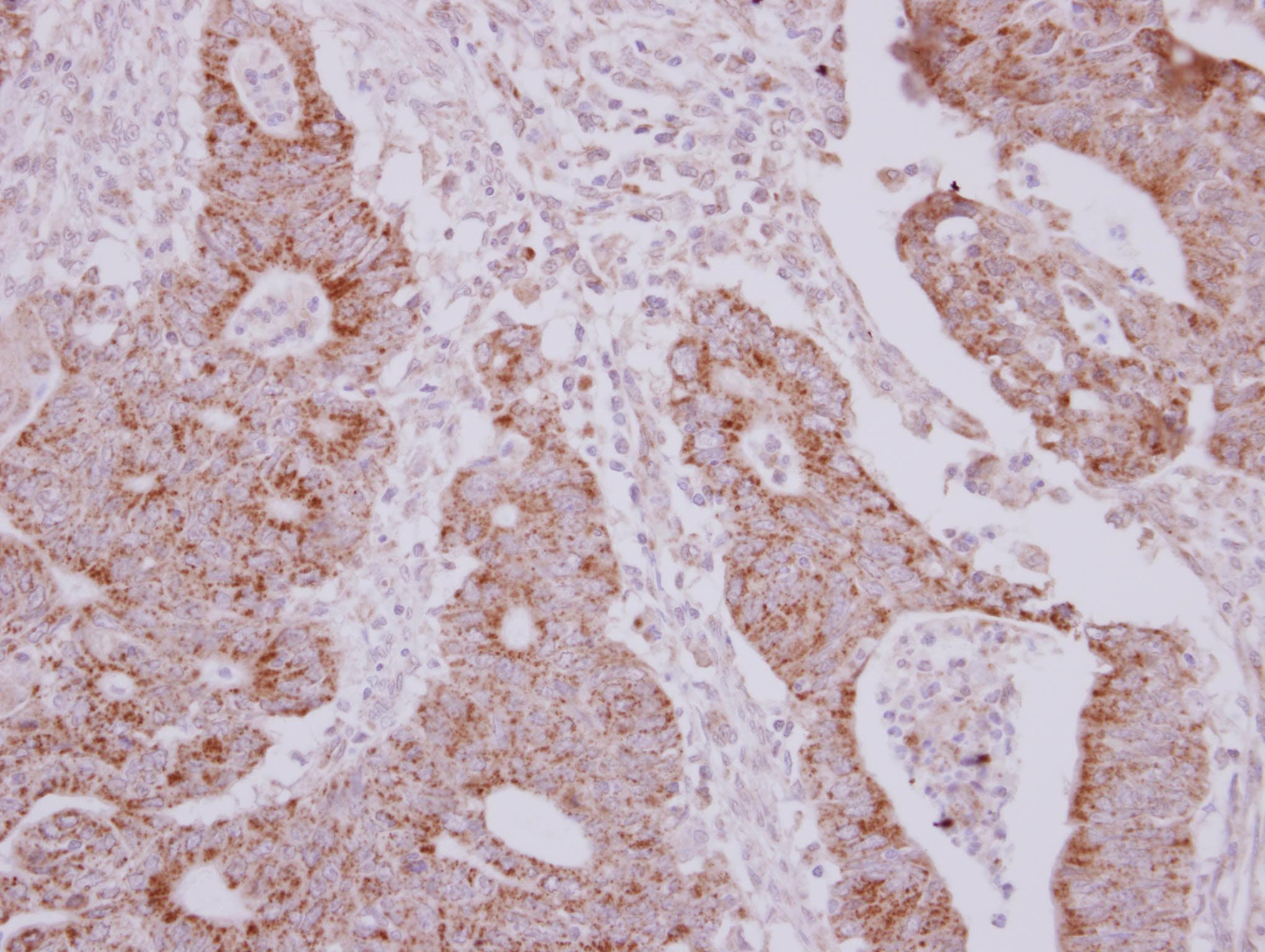 Polyclonal Rabbit anti-Human NARS2 Antibody (IHC, WB)
