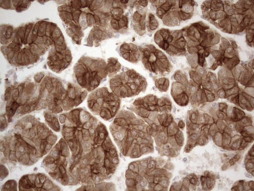KRT18 / CK18 / Cytokeratin 18 Antibody (aa69-372, clone OTI2H10)