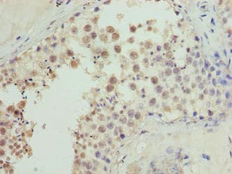 Polyclonal Rabbit anti-Human CDADC1 Antibody (IHC)