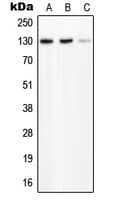 PLCB2 Antibody (Internal)