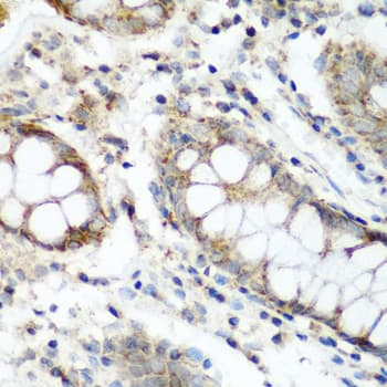 NAT15 Antibody