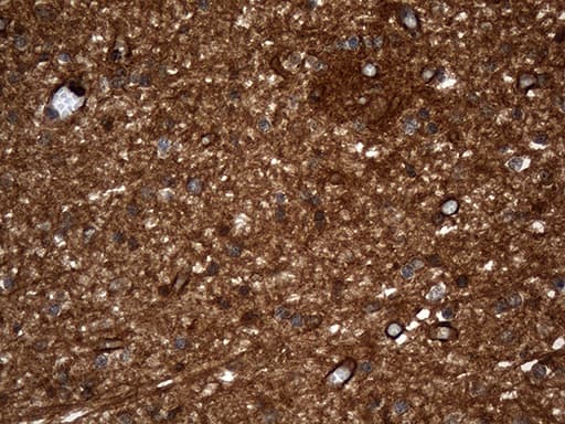 GNPAT / DHAP-AT Antibody (clone OTI2F8, Carrier-free)