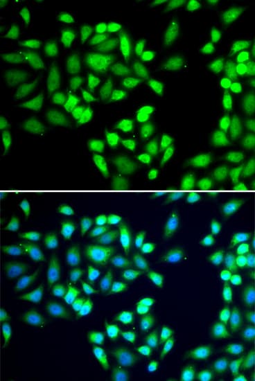 SGTA / SGT Antibody