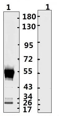 SARS-CoV-2 Nucleoprotein Antibody