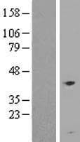 SDHC Protein (Over-Expression Lysate Myc-DDK (Flag))