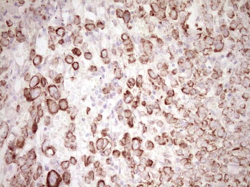 Monoclonal Mouse anti-Human Peripherin Antibody (clone OTI2D5, Carrier-free, IHC, WB)
