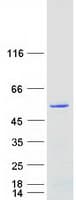 Human ARRDC1 Protein (Recombinant Myc-DDK (Flag))