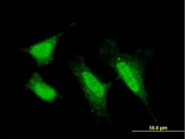 PRKCI / PKC Iota Antibody (clone 1G11)