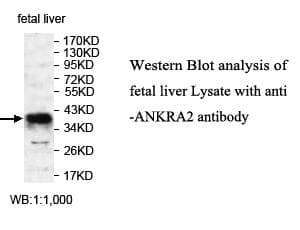 ANKRA2 / ANKRA Antibody (aa50-271)