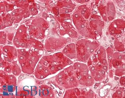 IHC-plus™ Polyclonal Rabbit anti-Human KLK1 / Kallikrein 1 Antibody (IHC, WB)