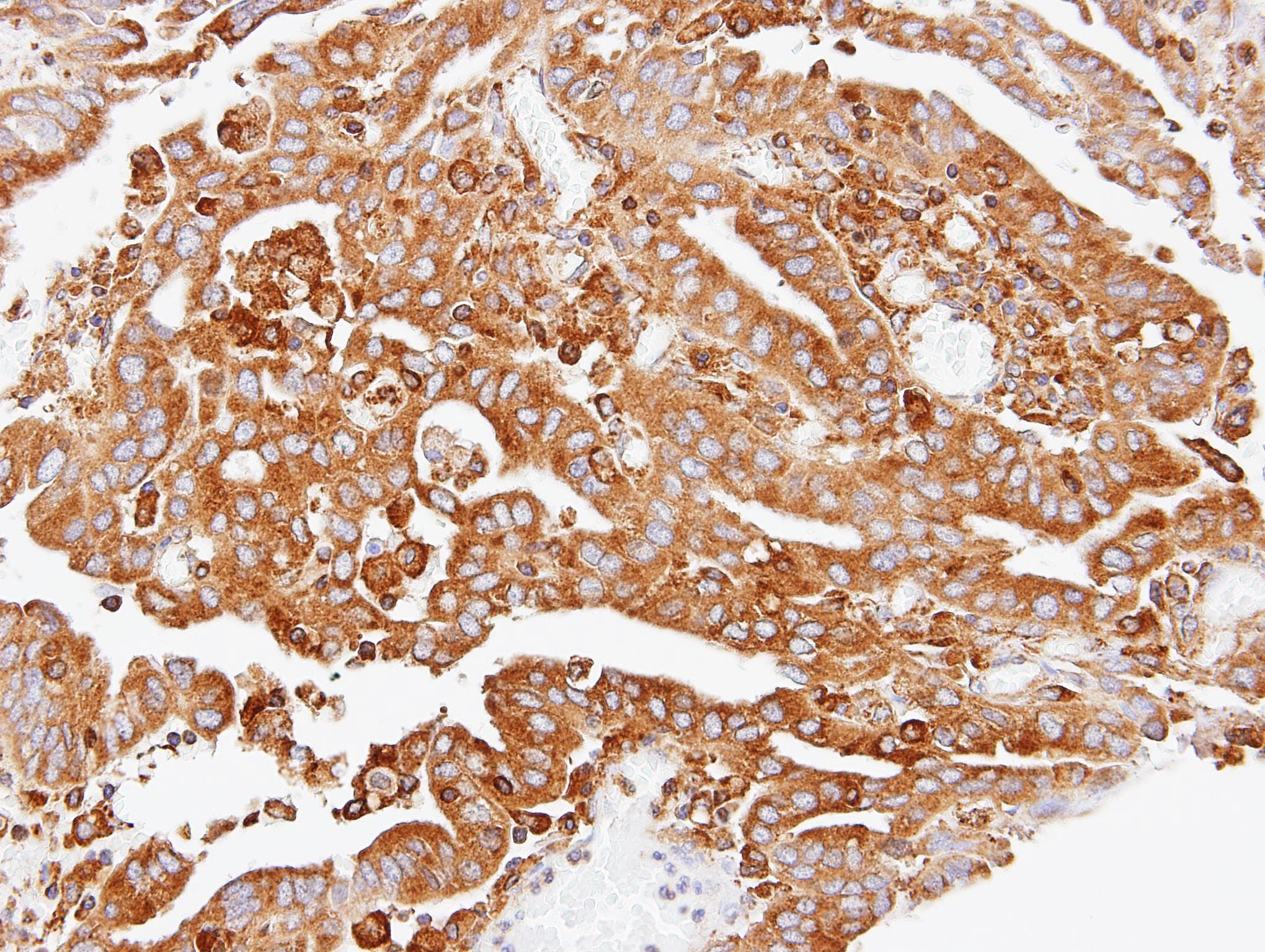 Polyclonal Rabbit anti-Human ARPC2 / p34-Arc Antibody (aa14-300, IHC, WB)