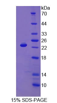 Sheep IFNA / Interferon Alpha Protein (Recombinant His)