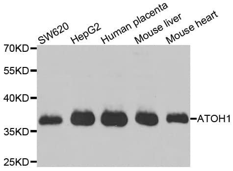 ATOH1 / MATH-1 Antibody