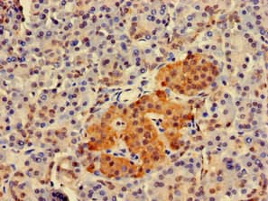 TWF1 / PTK9 Antibody