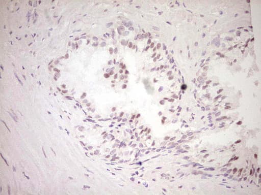 DVL2 / Dishevelled 2 Antibody (aa1-320, clone OTI2D11)