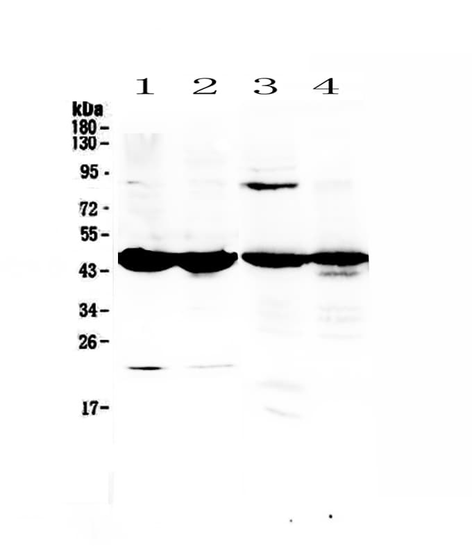 Polyclonal Rabbit anti-Rat ADA / Adenosine Deaminase Antibody (IHC, WB)