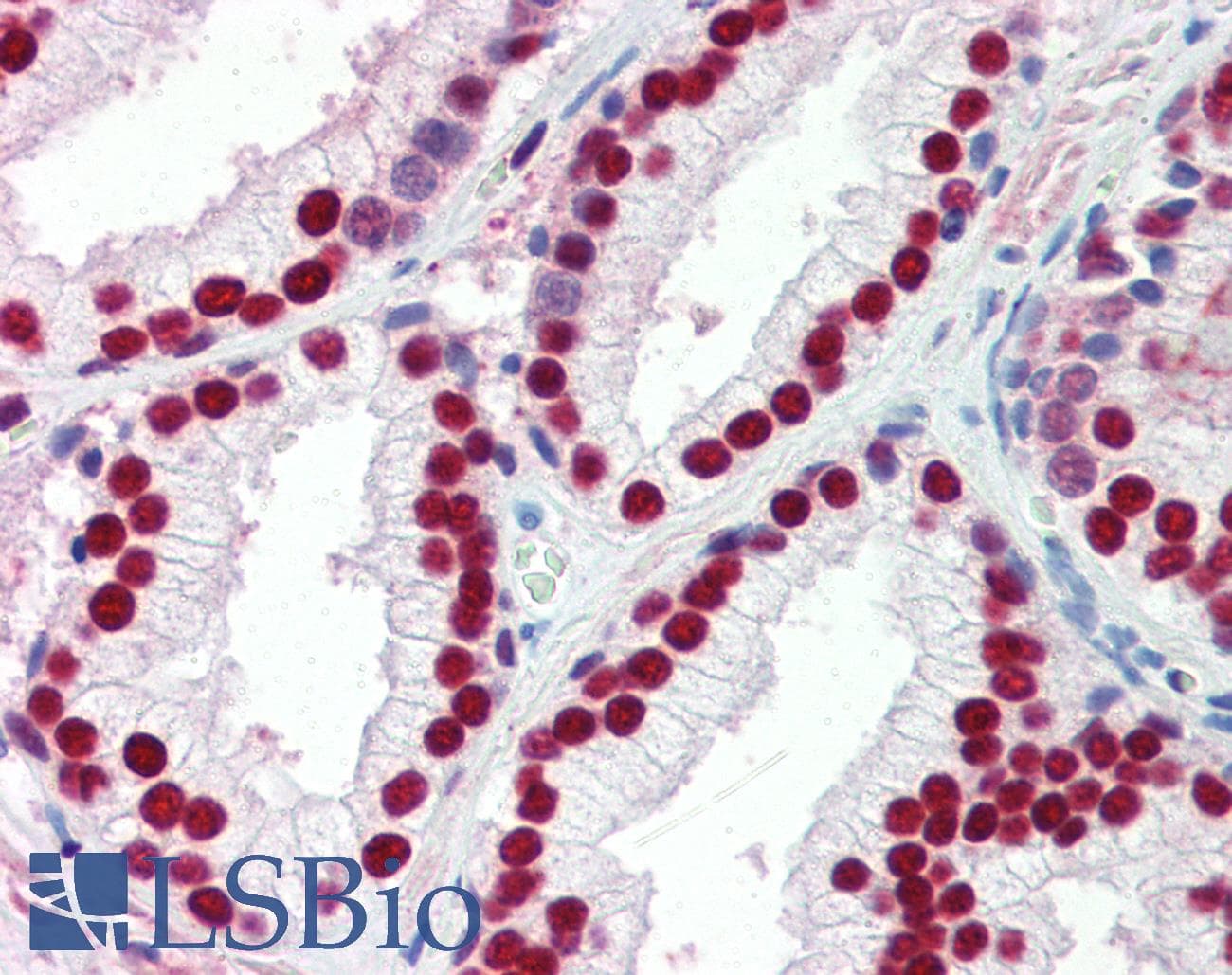SSB / La Antibody (aa82-131)
