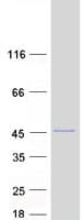 Human ARPC1A Protein (Recombinant Myc-DDK (Flag))