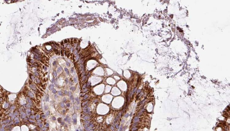 PLDN / Pallidin Antibody