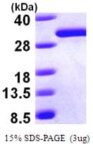 Human DCXR Protein (Recombinant His)
