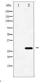 CDKN1B / p27 Kip1 Antibody
