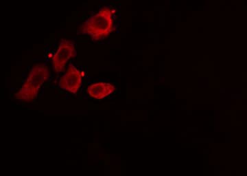 CAV1 / Caveolin 1 Antibody