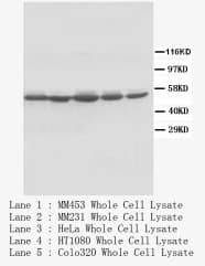 Polyclonal Rabbit anti-Human FOS / c-FOS Antibody (Internal, WB)