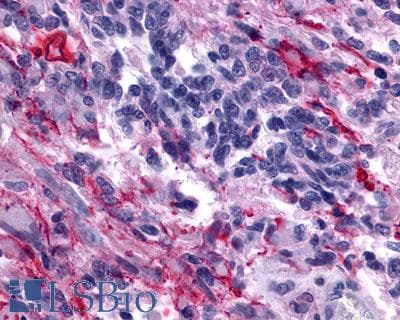 PathPlus™ Polyclonal Rabbit anti-Human OXTR / Oxytocin Receptor Antibody (N-Terminus, IHC)