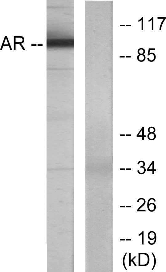 IHC-plus™ AR / Androgen Receptor Antibody (aa621-670)