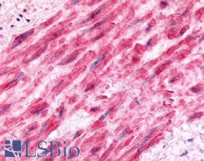 PathPlus™ Polyclonal Rabbit anti-Human BDKRB2/Bradykinin B2 Receptor Antibody (C-Terminus, IHC)