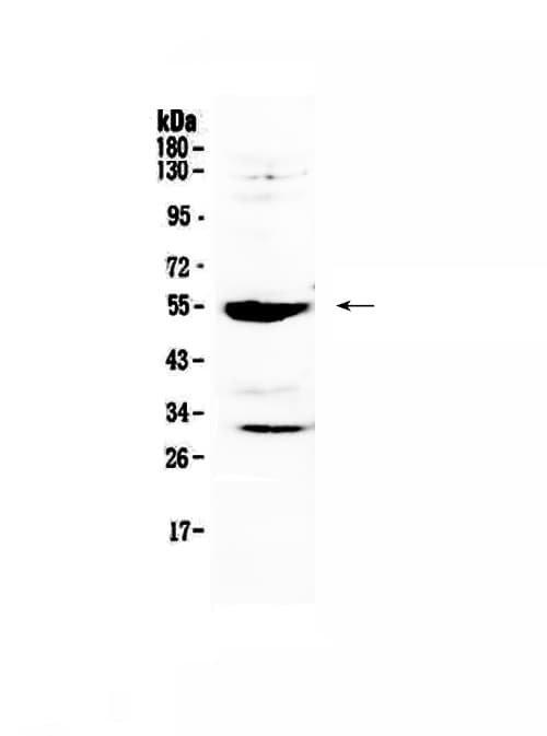MMP13 Antibody