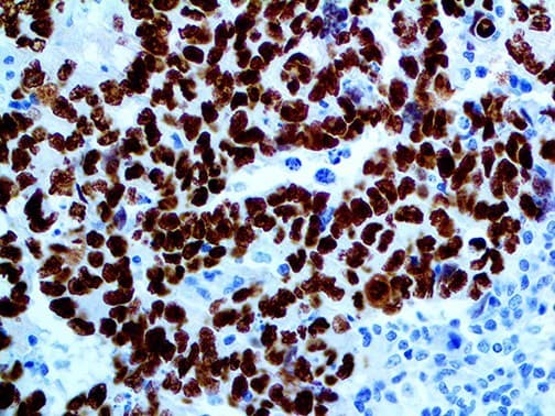 SALL4 Antibody (clone 6000)