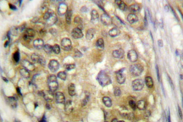 Polyclonal Rabbit anti-Human BIRC5 / Survivin Antibody (Asn111, IHC, IF, WB)